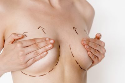 breast-lift-Turkey